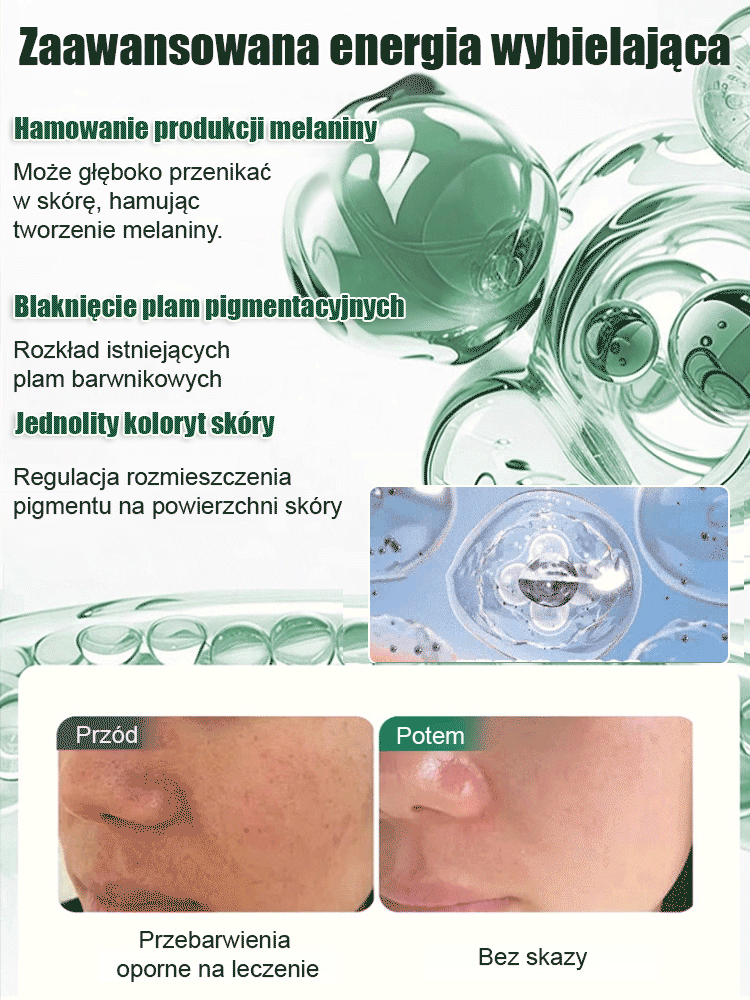 【Jedno psiknięcie, natychmiastowe usunięcie】Wybielający spray na przebarwienia