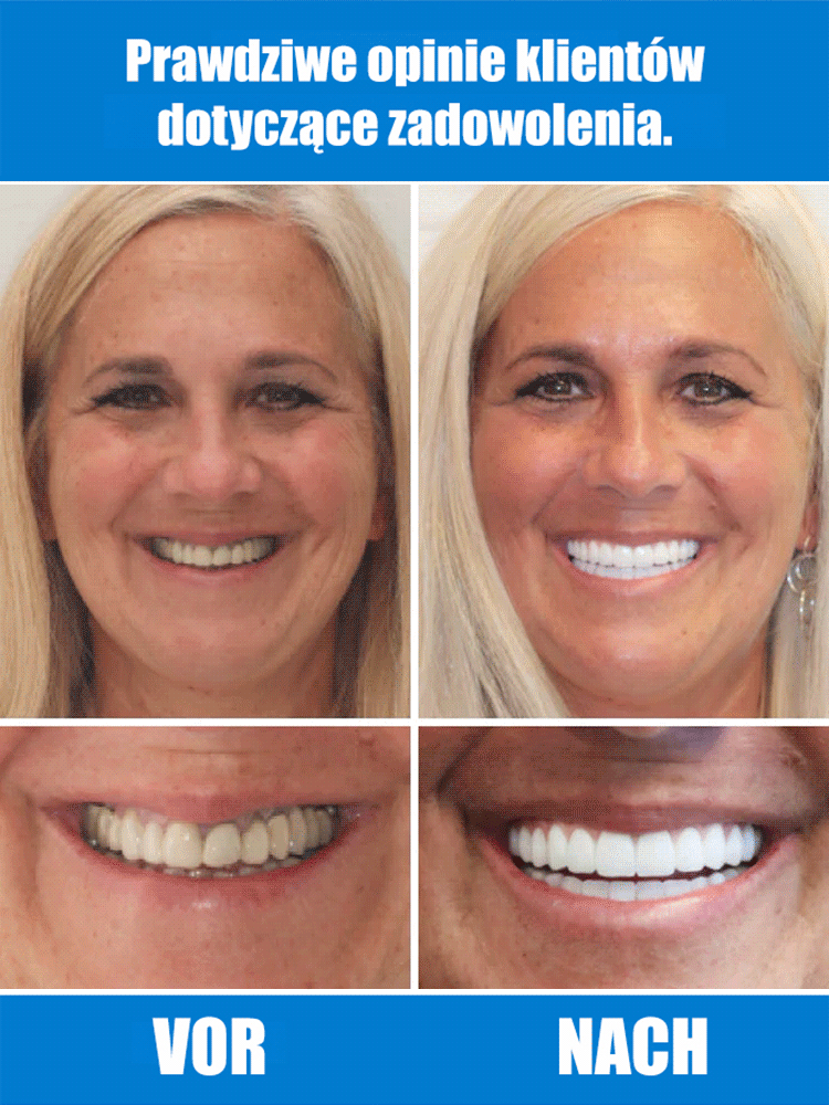 【FDA&BDA podwójna certyfikacja】Samokształtujące się protezy zębowe