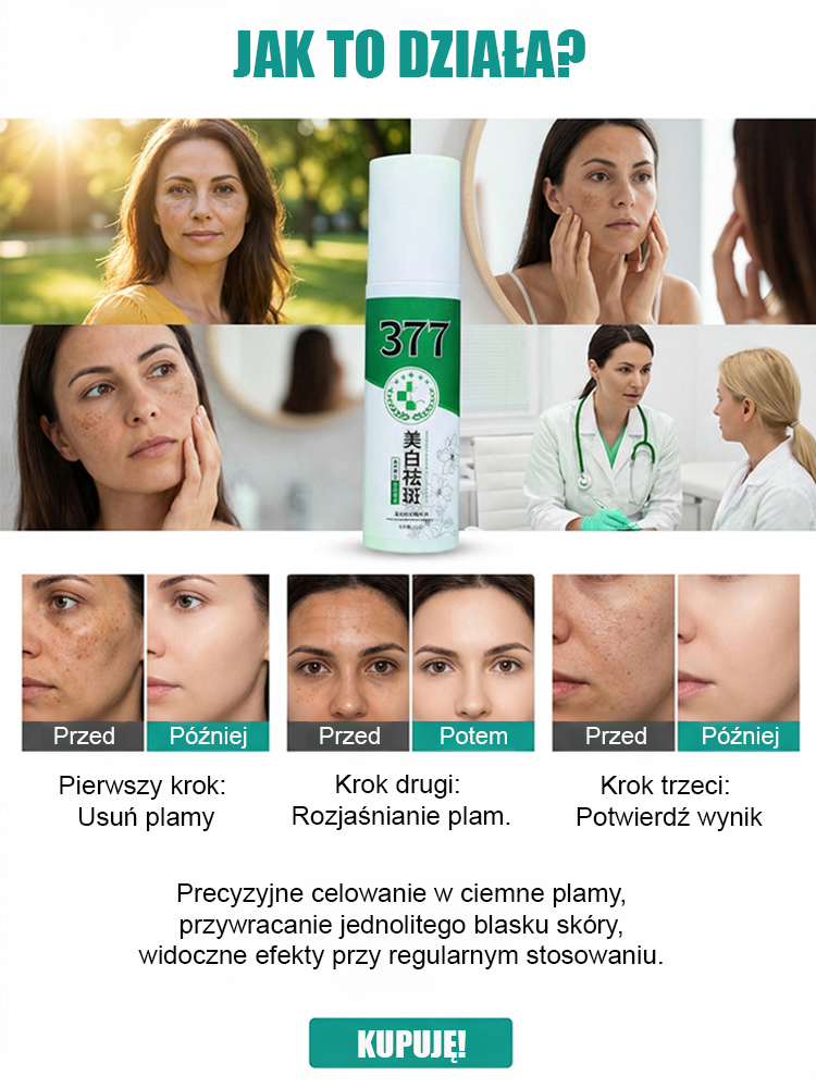 【Jedno psiknięcie, natychmiastowe usunięcie】Wybielający spray na przebarwienia