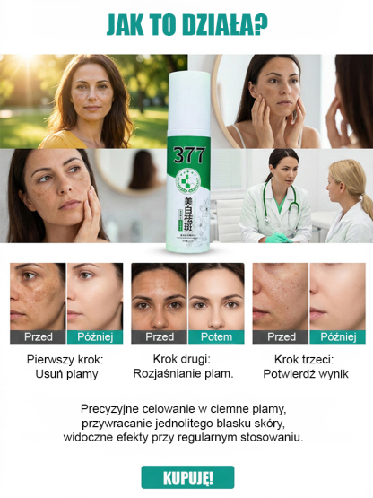 【Jedno psiknięcie, natychmiastowe usunięcie】Wybielający spray na przebarwienia