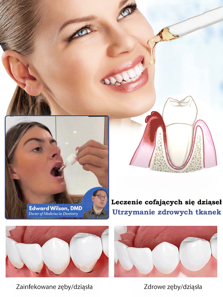 Krople do regeneracji zębów🦷🦷🦷 Naprawa Ubytków iOdbudowa Zębów