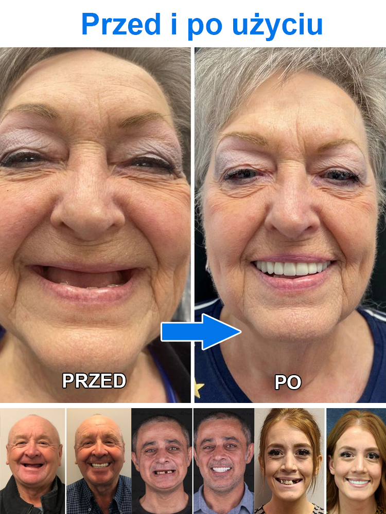 Funkcjonalny zestaw do protezy całkowitej.