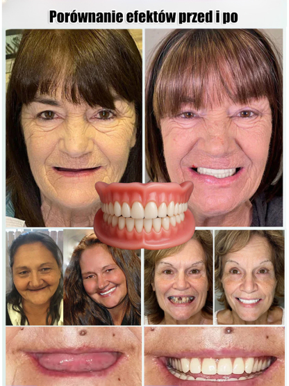 Bez kosztownego leczenia dentystycznego, bez bólu, bez czekania, 🦷🦷 uśmiech pełen pewności siebie w 3 sekundy