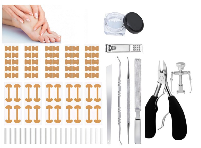 Ingrown toenail corrector, tweezers, C-shaped clip, and toe inflammation treatment kit