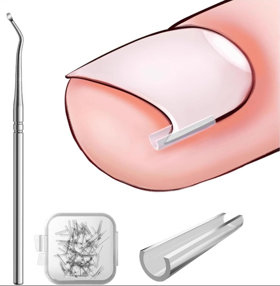 Ingrown toenail corrector, tweezers, C-shaped clip, and toe inflammation treatment kit