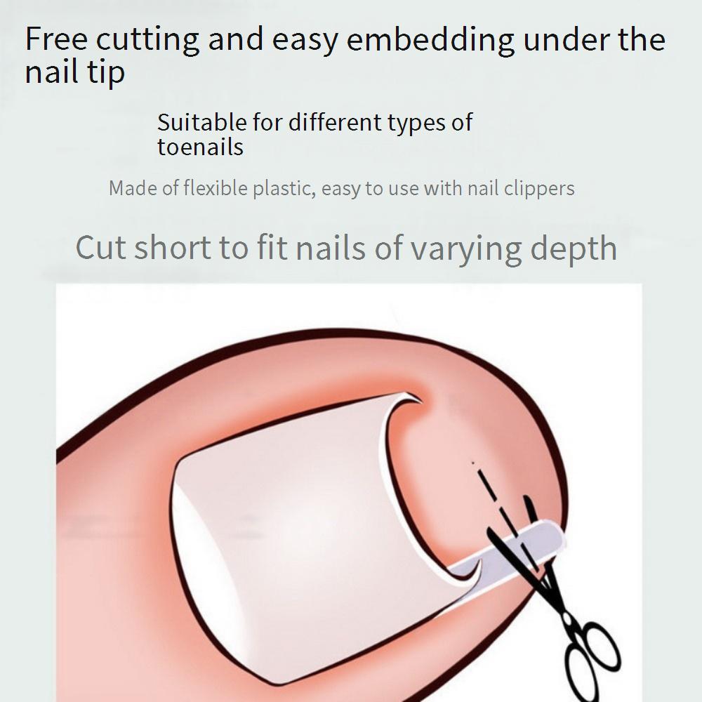 Ingrown toenail corrector, tweezers, C-shaped clip, and toe inflammation treatment kit