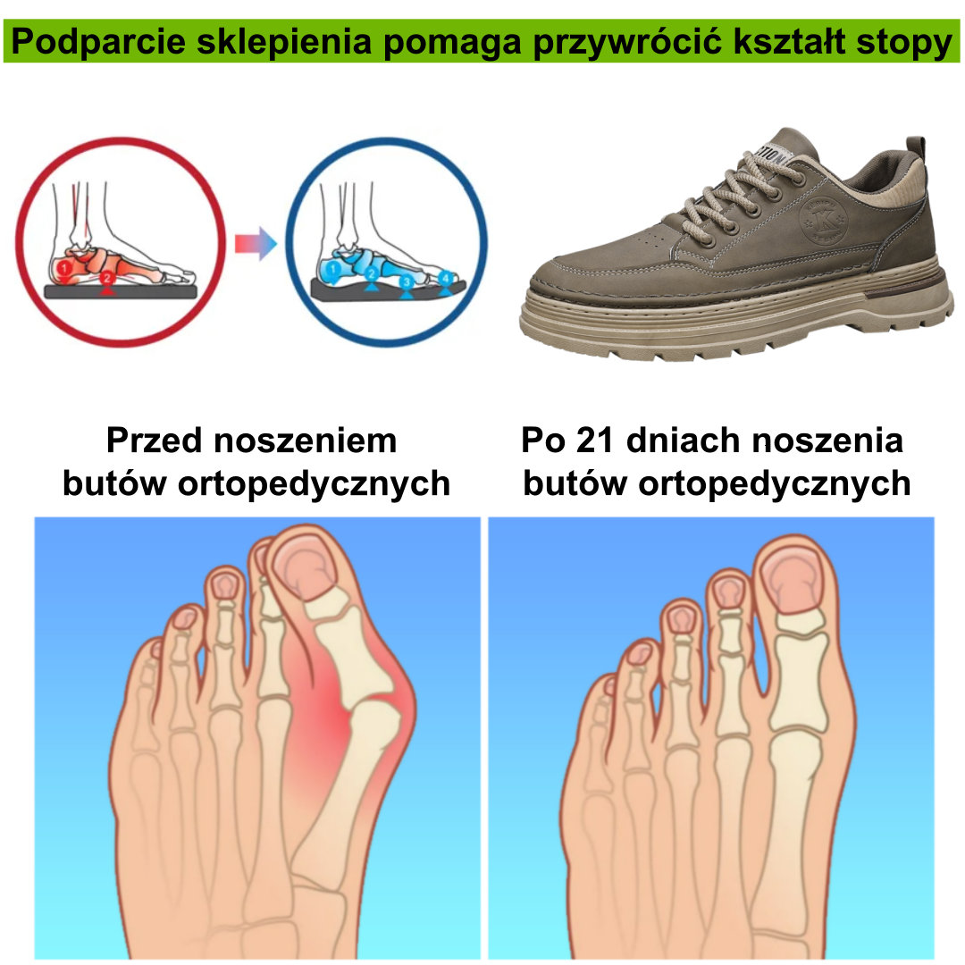 ⚡Ograniczona czasowo zniżka 50%🔥 — ergonomicznie zaprojektowane buty ortopedyczne, które łagodzą ból stóp, pleców i stawów; wodoodporne, antypoślizgowe i wygodne w noszeniu.