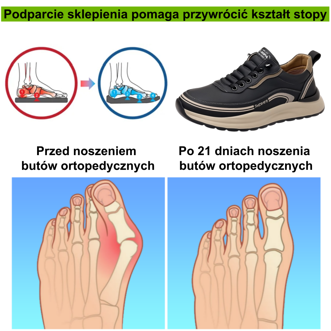[⏰50% zniżki dzisiaj - nie przegap] Ergonomiczne buty trekkingowe - ✅️ Korygują styl chodzenia - Wyselekcjonowana włoska skóra
