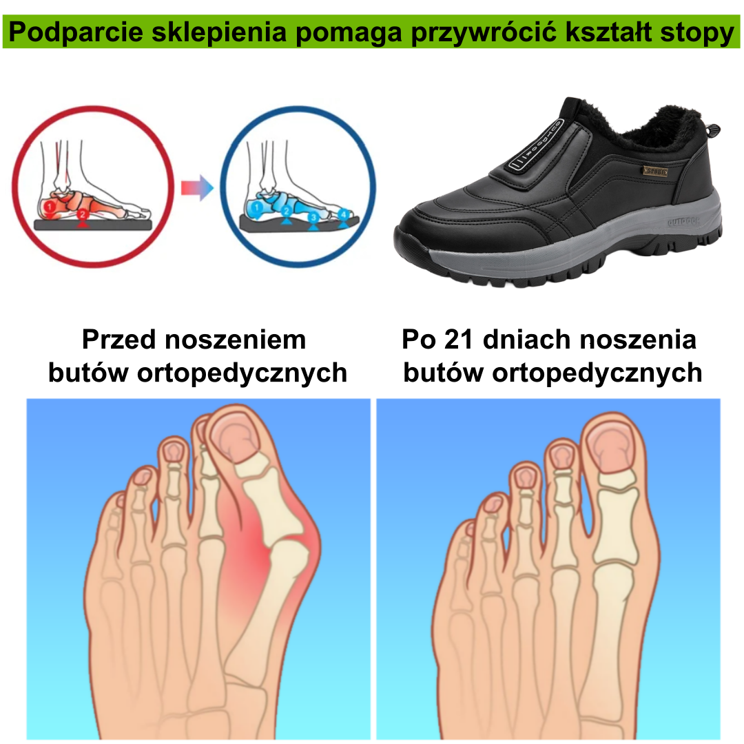 【🎄Specjalna oferta świąteczna: 50% zniżki – nie przegap】Ergonomiczne, ciepłe buty zimowe – ✅️Korygują postawę podczas chodzenia – Wodoodporne i antypoślizgowe 👞Wyselekcjonowana włoska skóra