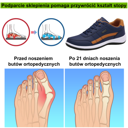 【🎄Specjalna oferta świąteczna: 70% zniżki – nie przegap】Ergonomiczne buty ortopedyczne – ✅️ Korygują postawę podczas chodzenia – Wodoodporne i antypoślizgowe 👞Wyselekcjonowana włoska skóra