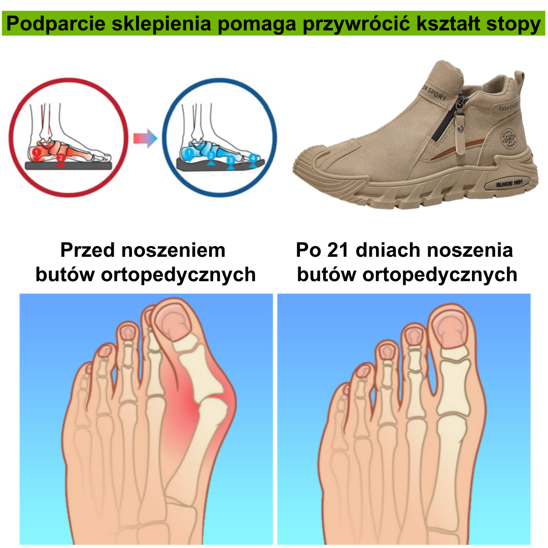 【⏰50% zniżki dzisiaj - nie przegap】Ergonomiczne buty ortopedyczne – ✅️ Korygują postawę podczas chodzenia – Wodoodporne i antypoślizgowe 👞Wyselekcjonowana włoska skóra