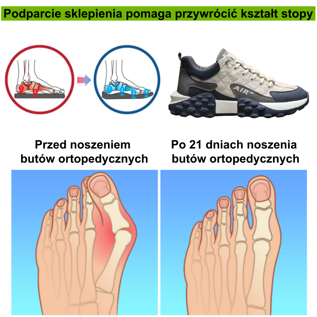 【🎆Szczęśliwego Nowego Roku!⏰50% zniżki dzisiaj - nie przegap】Ergonomiczne buty ortopedyczne – ✅️ Korygują postawę podczas chodzenia – Wodoodporne i antypoślizgowe 👞Wyselekcjonowana włoska skóra