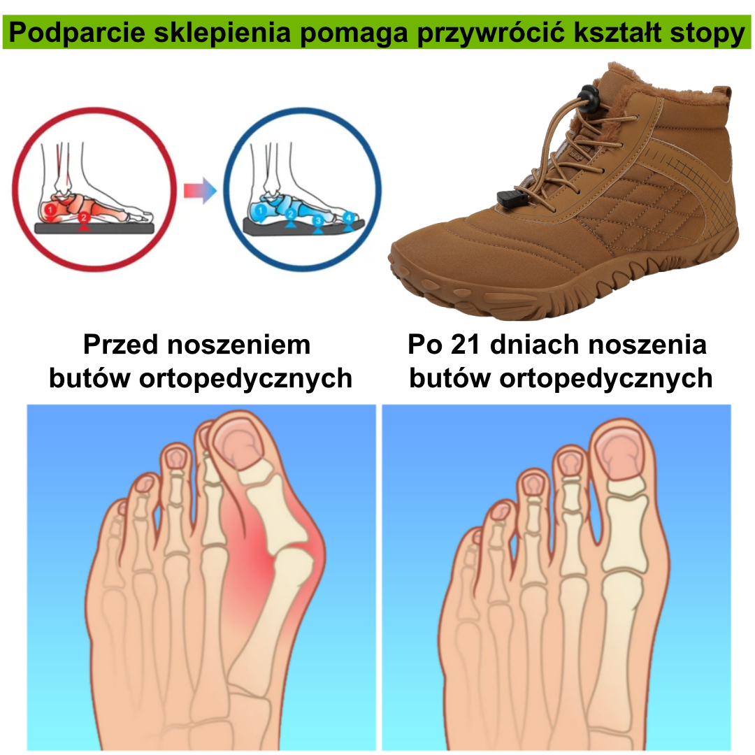 【⏰50% zniżki dzisiaj - nie przegap】Ergonomiczne, ciepłe buty zimowe – ✅️Korygują postawę podczas chodzenia – Wodoodporne i antypoślizgowe 👞