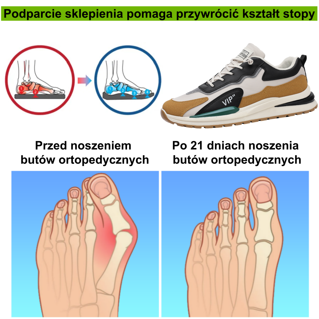 【⏰50% zniżki dzisiaj - nie przegap】Ergonomiczne buty ortopedyczne – ✅️ Korygują postawę podczas chodzenia – Wodoodporne i antypoślizgowe 👞Wykonane z oryginalnej australijskiej skóry bydlęcej