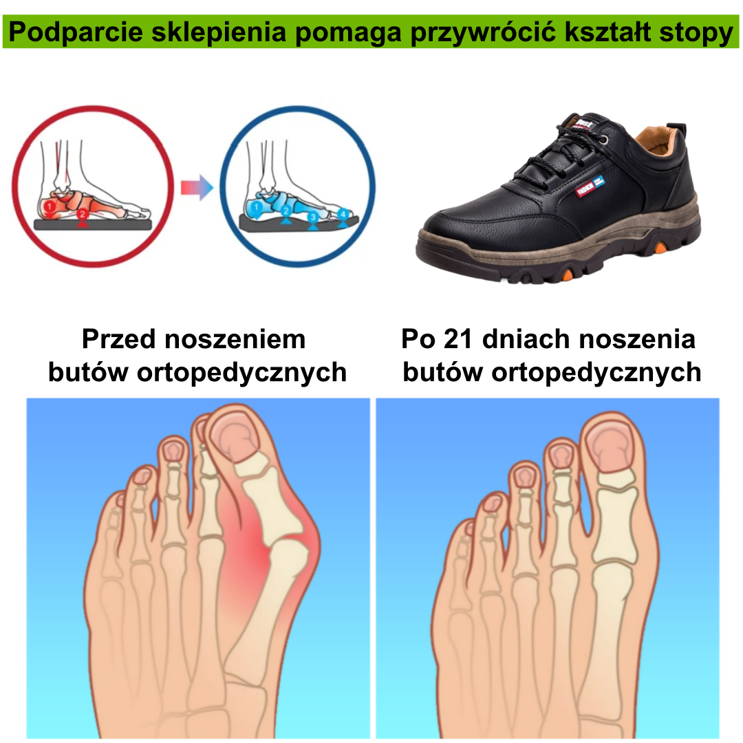 【⏰Oferta ograniczona czasowo: 70% zniżki – nie przegap】Nowe ergonomiczne buty ortopedyczne – ✅️ Korygują postawę podczas chodzenia – Ulepszone, wodoodporne i antypoślizgowe 👞 Wykonane z prawdziwej australijskiej skóry bydlęcej