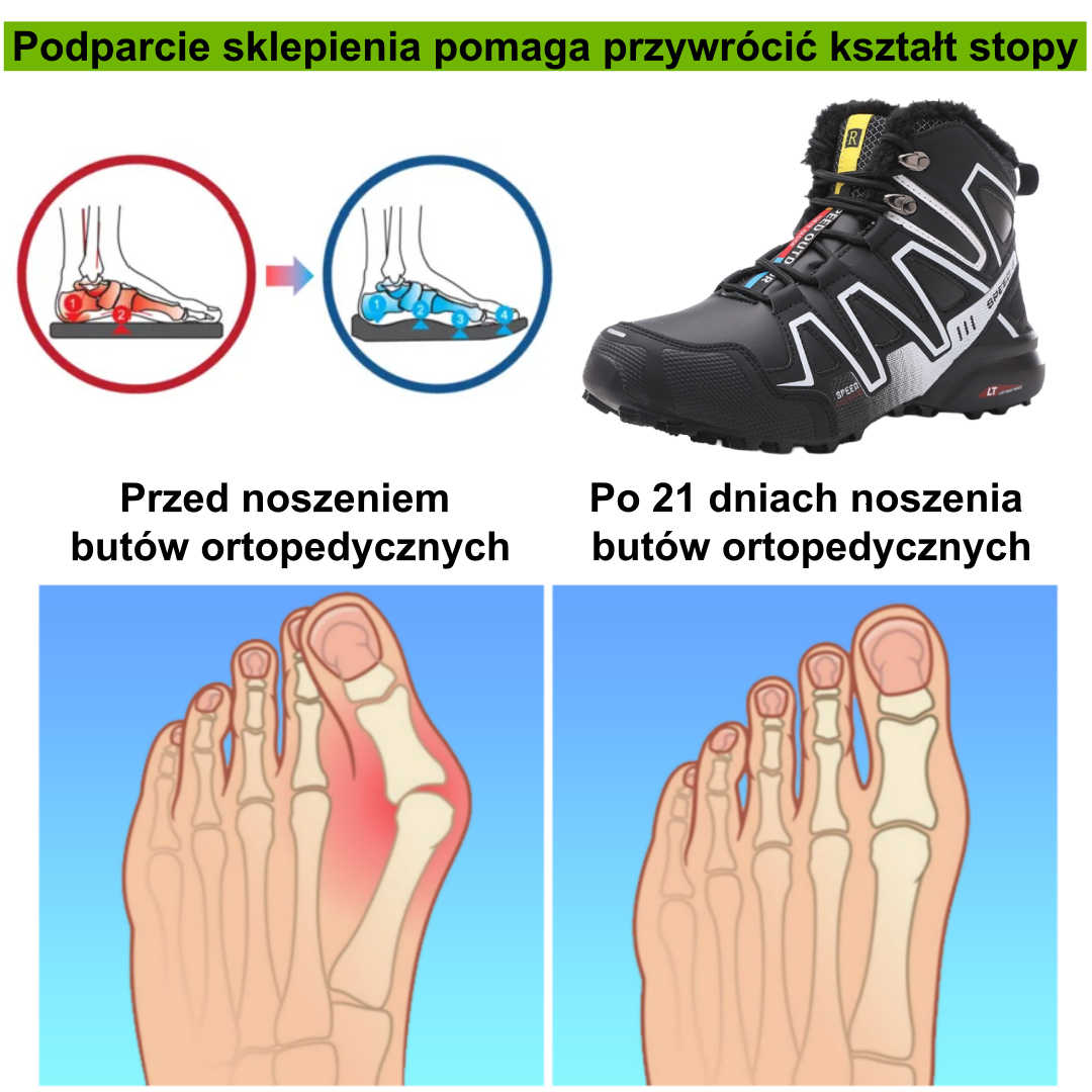 ⚡Ograniczona czasowo zniżka 50%🔥 — Ergonomicznie zaprojektowane buty ortopedyczne, które łagodzą ból stóp, pleców i stawów;
