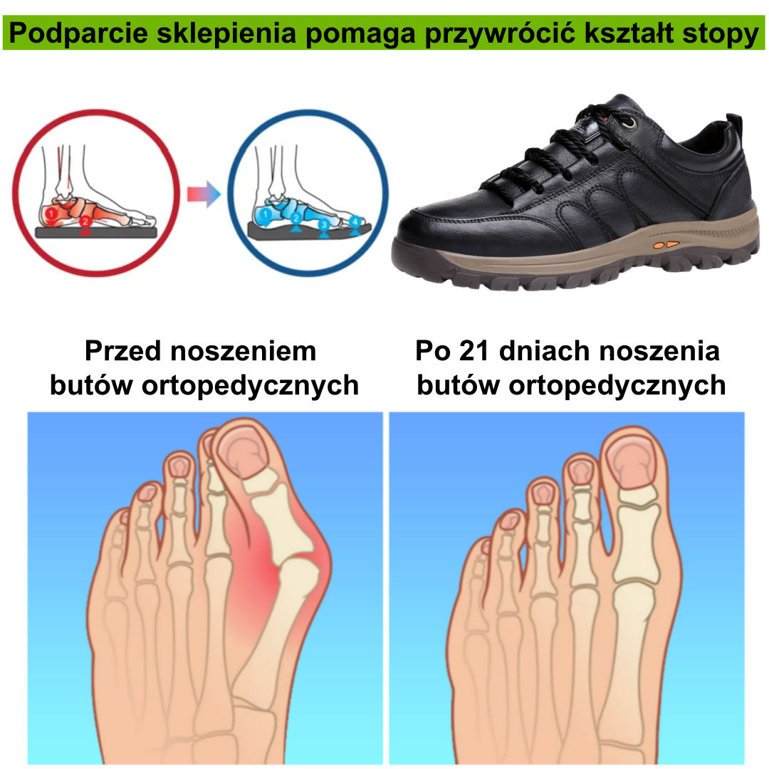 【⏰Oferta ograniczona czasowo: 70% zniżki - Nie przegap】Ergonomiczne buty ortopedyczne – ✅️ Korygują postawę podczas chodzenia – Wodoodporne i antypoślizgowe 👞Wykonane z oryginalnej australijskiej skóry bydlęcej