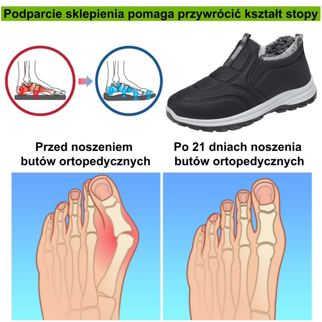 ⚡Ograniczona zniżka 50% —— Ergonomiczne buty ortopedyczne z futrzaną wyściółką, łagodzą ból stóp, pleców i stawów, unisex