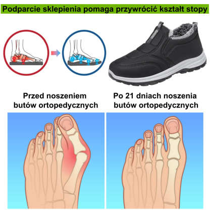 ⚡Ograniczona zniżka 50% —— Ergonomiczne buty ortopedyczne z futrzaną wyściółką, łagodzą ból stóp, pleców i stawów, unisex