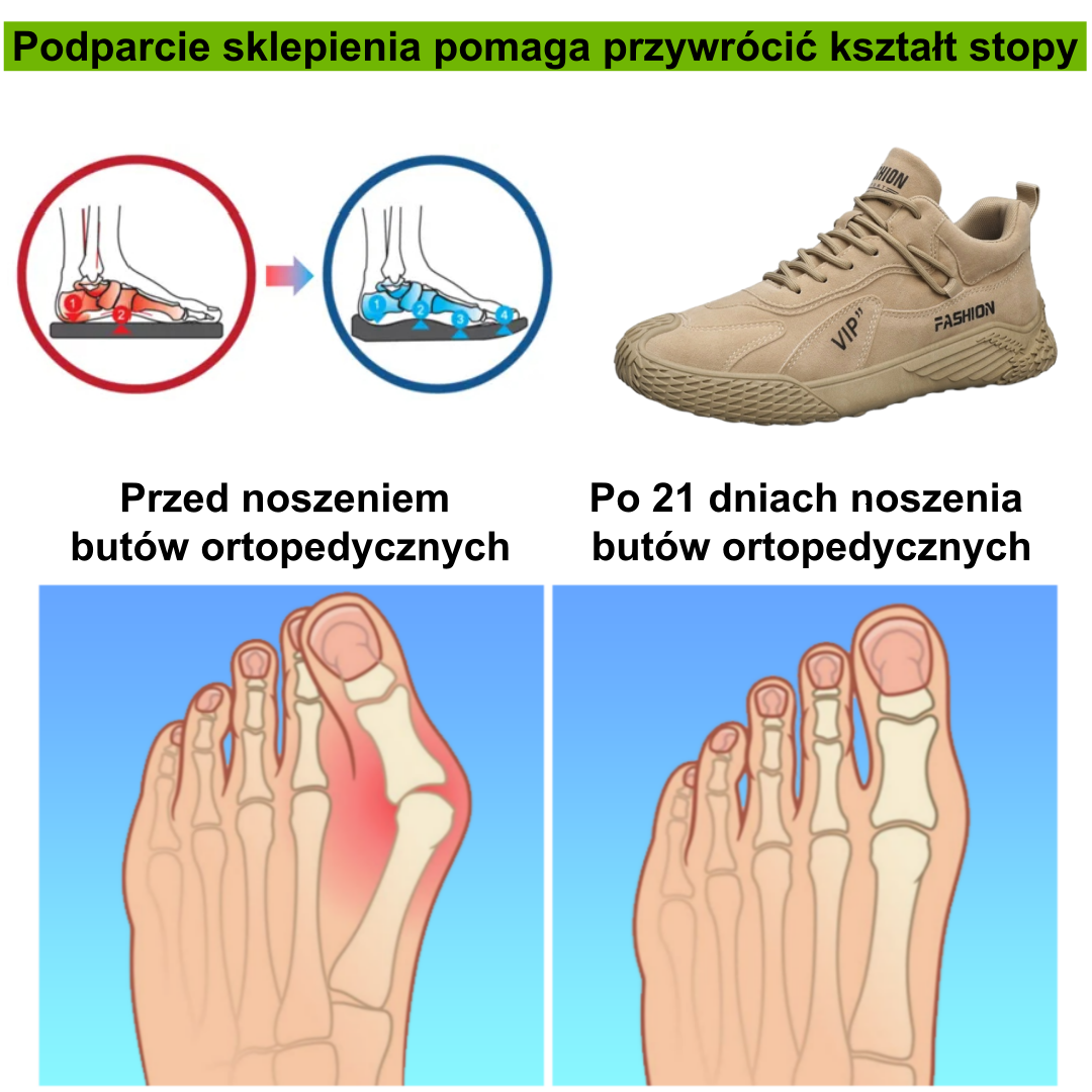 [⏰50% zniżki dzisiaj - nie przegap] Ergonomiczne buty trekkingowe - ✅️ Korygują styl chodzenia - Wyselekcjonowana włoska skóra