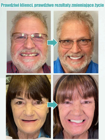 Regulowane i adaptacyjne pełne protezy z pewnym uśmiechem