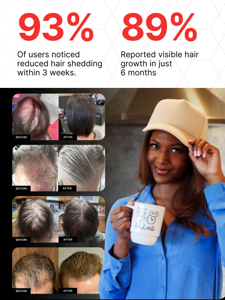  Hair Regrowth Cap for Moderate to Severe Hair Loss, Professional Salon Technology