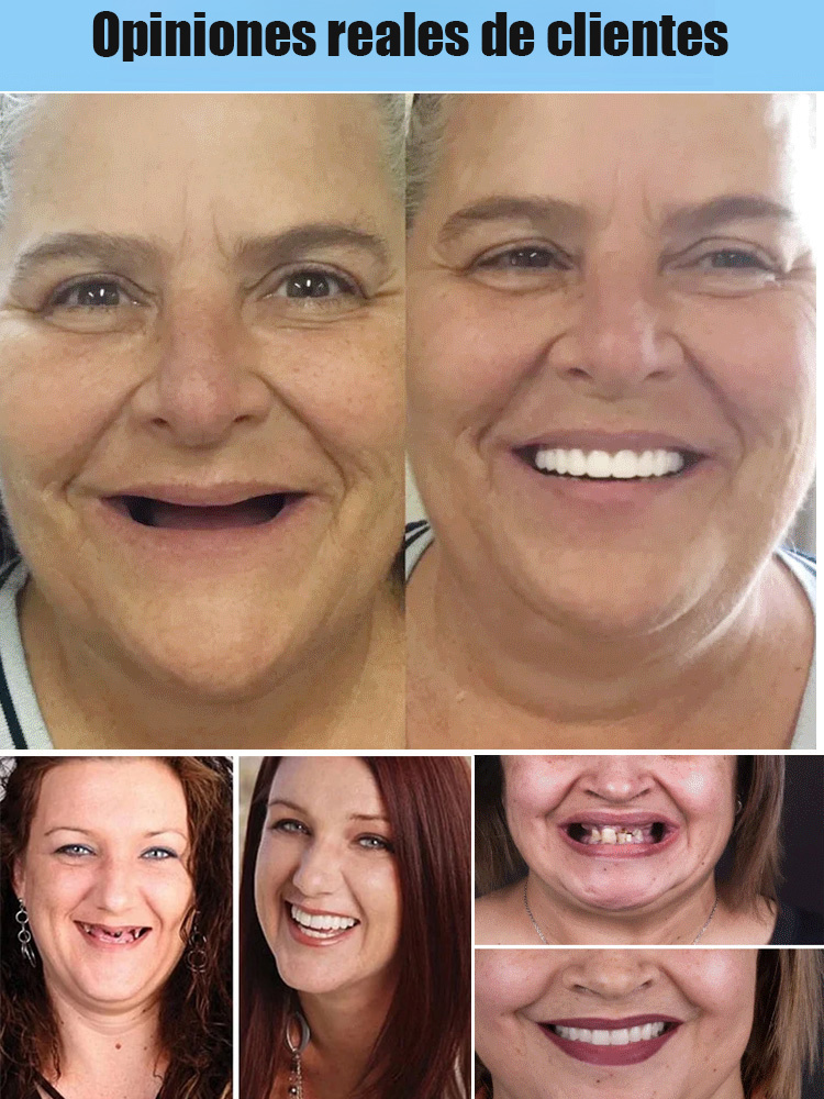 Conjunto de ajuste y embellecimiento para dentaduras postizas