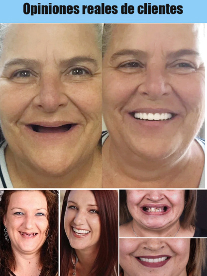 Conjunto de ajuste y embellecimiento para dentaduras postizas