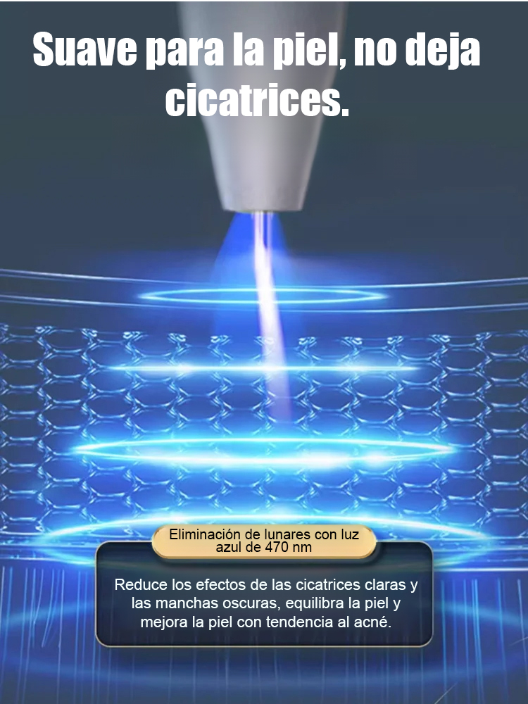 Lápiz láser para eliminar verrugas sin dolor