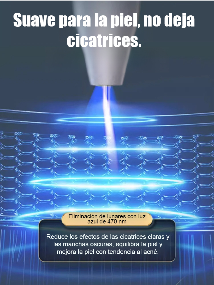 Lápiz láser para eliminar verrugas sin dolor