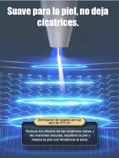 Lápiz láser para eliminar verrugas sin dolor