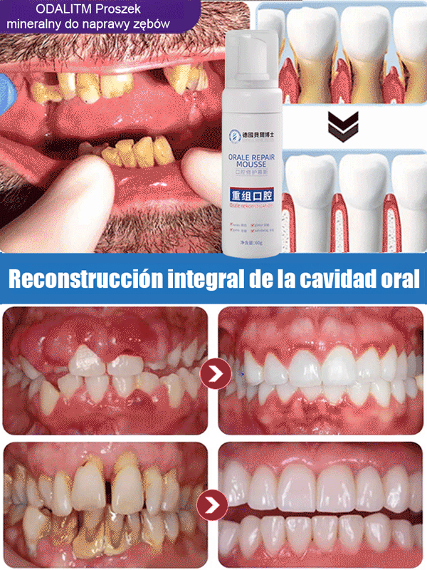 Espuma reparadora oral de grado médico recombinante