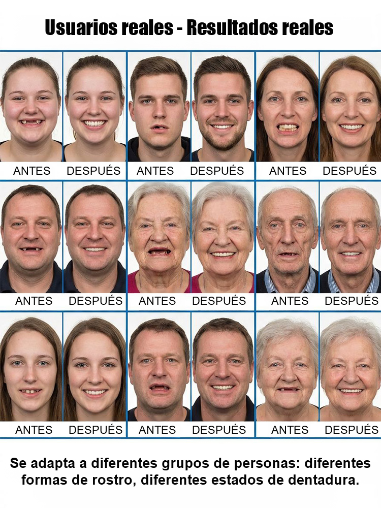 Aparato ortodóntico de ajuste perfecto adaptable a la forma del rostro