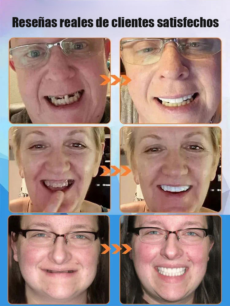 【Nuevo resultado de investigación en el Reino Unido】Fundas de dientes simuladas de silicona