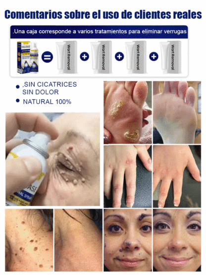 Spray Refrescante Calmante