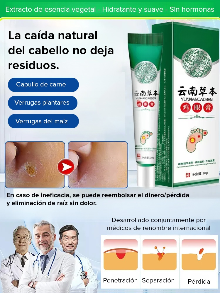 Crema herbal para eliminar callos de pollo sin dolor en 7 días.