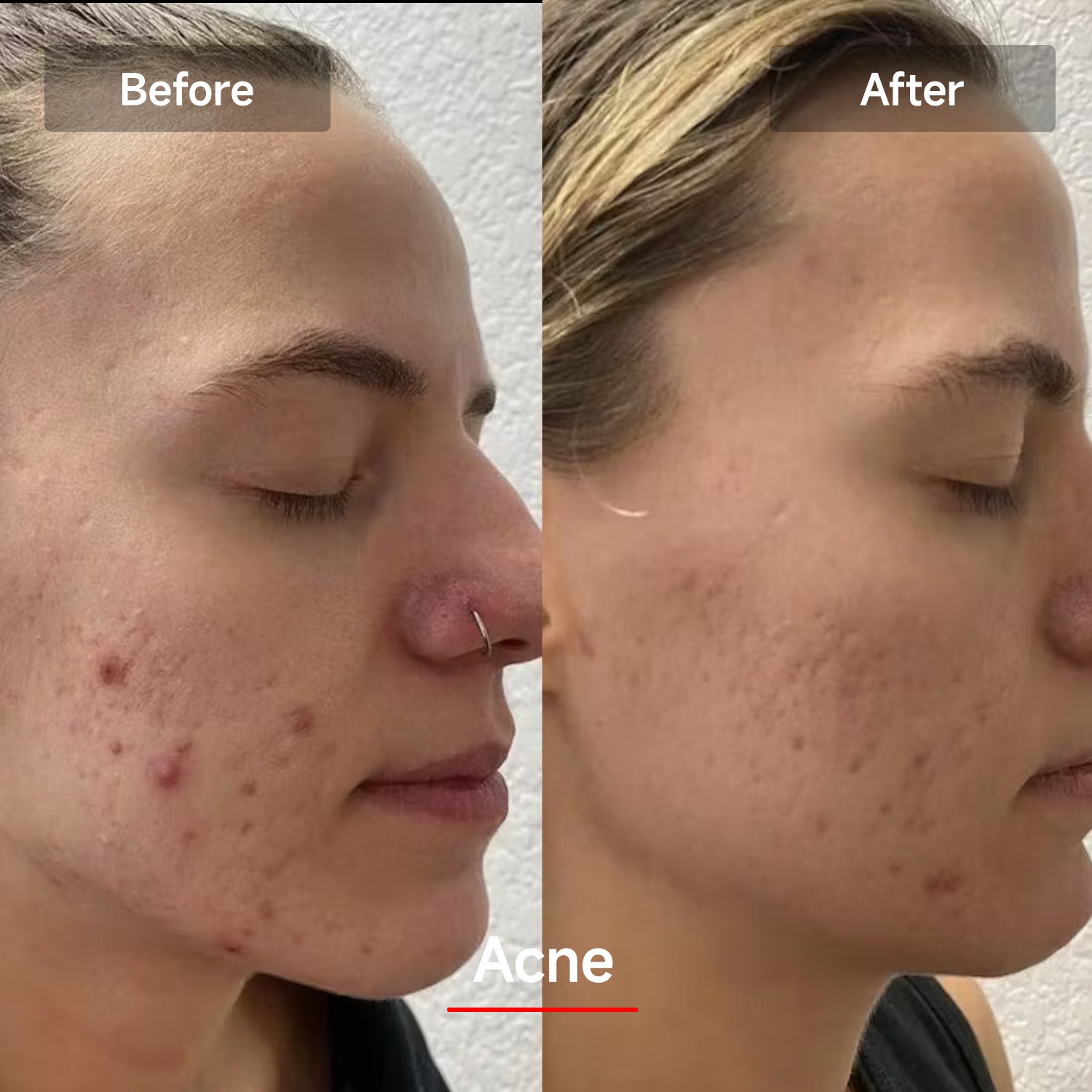 Veonskin LED Face Mask Pro – 7-Color Light Therapy for Skincare