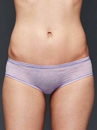 Breathe Hipster - peach stripe