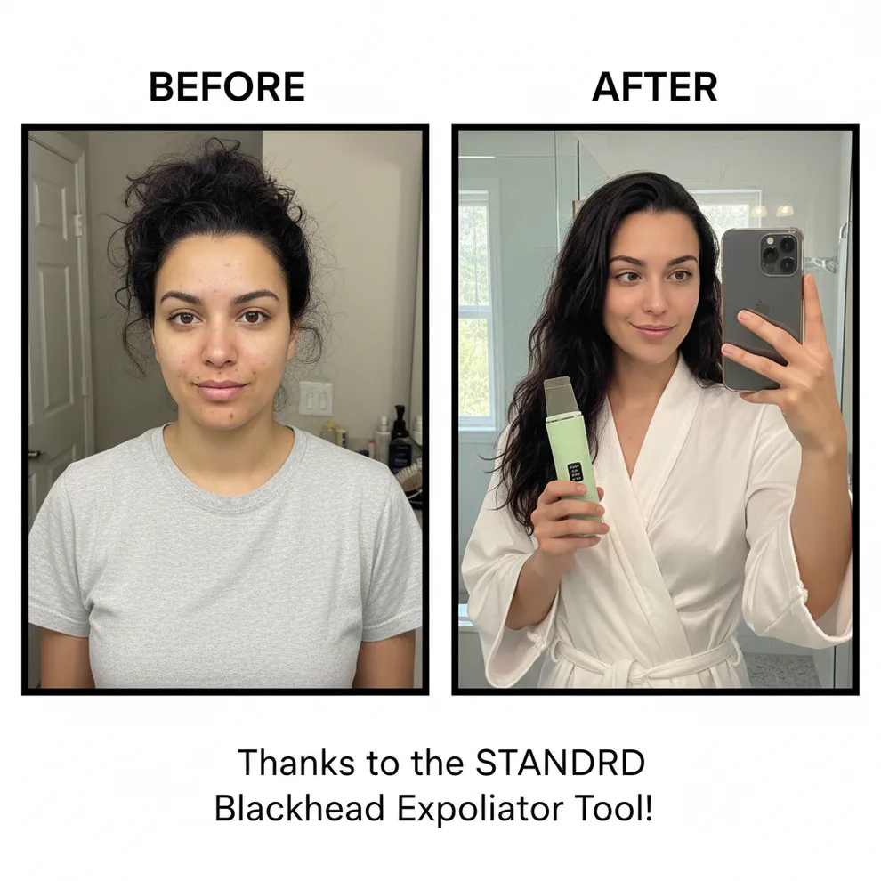STANDRD Deep Pore Ultrasonic Exfoliator