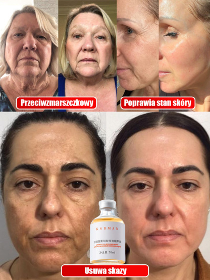 【Wyniki w ciągu 7 dni】Kolagen medyczny przeciwstarzeniowy🐟️Przetestowany na ponad 12 000 osób, przywraca młodzieńczy wygląd skóry!