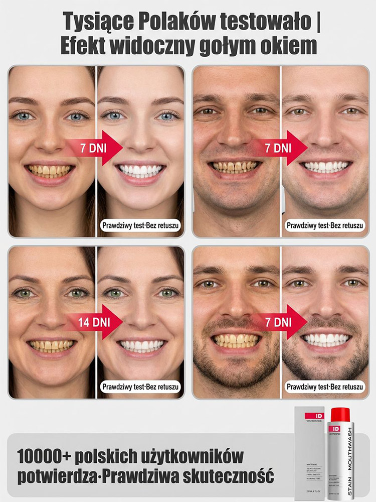 【Gorąco polecany przez dentystów】Delikatnie usuwa wieloletnie przebarwienia | Specjalnie opracowany dla wrażliwych zębów | Rozjaśnia i wybiela zęby