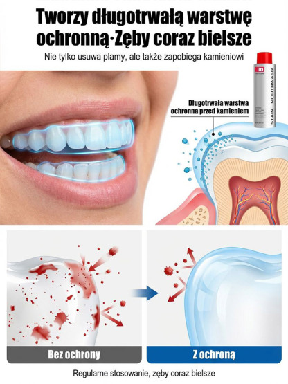 【Gorąco polecany przez dentystów】Delikatnie usuwa wieloletnie przebarwienia | Specjalnie opracowany dla wrażliwych zębów | Rozjaśnia i wybiela zęby