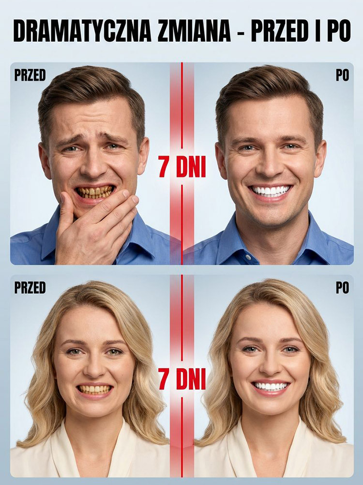 【Gorąco polecany przez dentystów】Delikatnie usuwa wieloletnie przebarwienia | Specjalnie opracowany dla wrażliwych zębów | Rozjaśnia i wybiela zęby