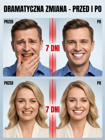 【Gorąco polecany przez dentystów】Delikatnie usuwa wieloletnie przebarwienia | Specjalnie opracowany dla wrażliwych zębów | Rozjaśnia i wybiela zęby