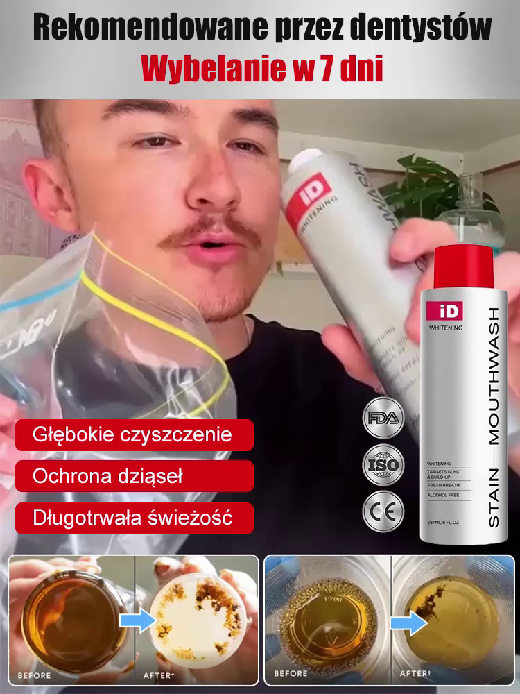 【Gorąco polecany przez dentystów】Delikatnie usuwa wieloletnie przebarwienia | Specjalnie opracowany dla wrażliwych zębów | Rozjaśnia i wybiela zęby