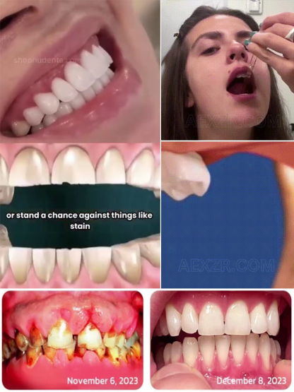 🦷 Krople do pielęgnacji zębów – naprawa, rozjaśnianie i regeneracja zębów!
