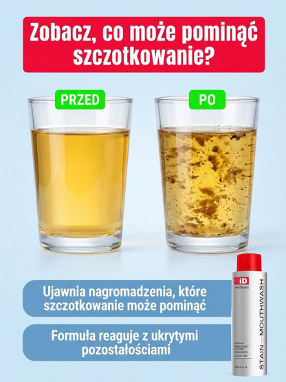 【Gorąco polecany przez dentystów】Delikatnie usuwa wieloletnie przebarwienia | Specjalnie opracowany dla wrażliwych zębów | Rozjaśnia i wybiela zęby