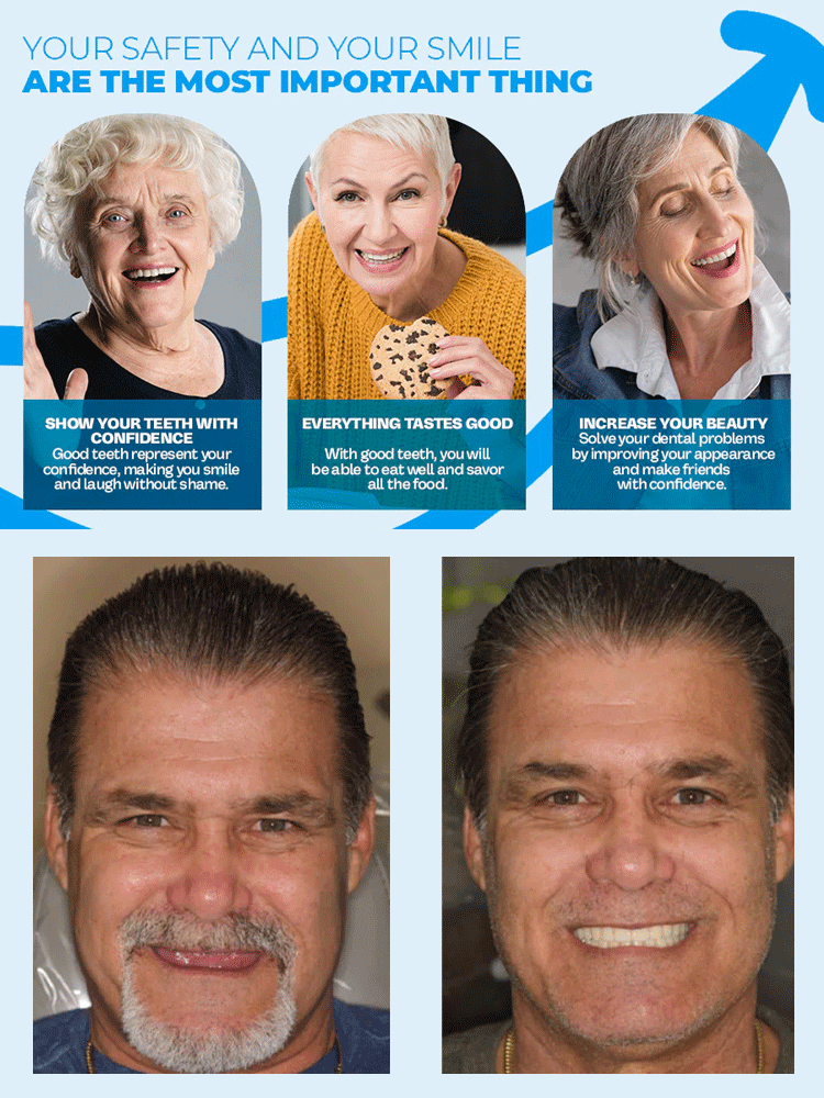 UK's #1 Custom Silicone Veneers 🦷 Boil & Bite, Eat Anything! Dentist-Free 🥇