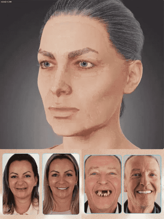 【FDA Zertifiziert】Prothesen-Reparaturset