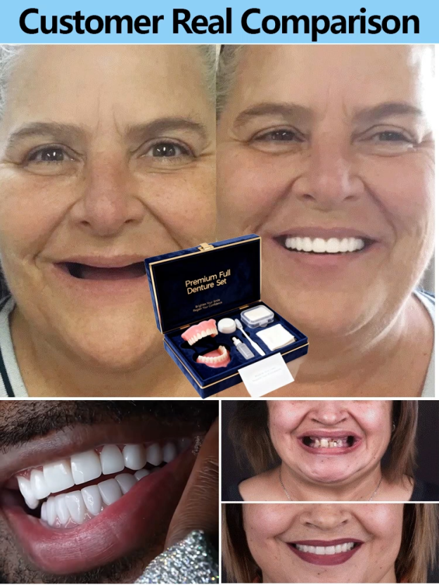 【Made in USA, FDA Approved】Custom Full Mouth Dentures Kit